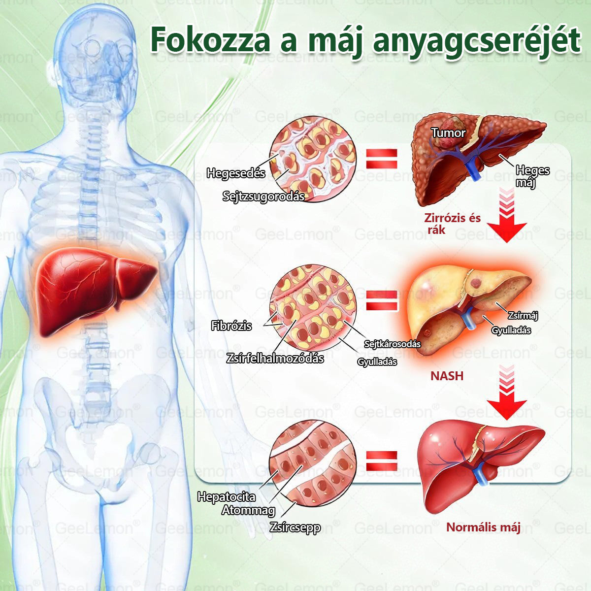 ▶Ajánlott a Semmelweis Kórház által · 👩‍⚕️BENU hivatalos üzlet| 🎁 𝐆𝐞𝑒𝐿𝑒𝐦𝐨𝐧® Glumasetide 8 az 1-ben Karcsú és Egészséges Nano Mikrotűs Tapasz
