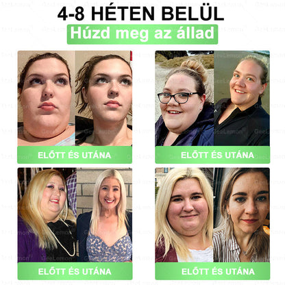 ▶Ajánlott a Semmelweis Kórház által · 👩‍⚕️BENU hivatalos üzlet| 🎁 𝐆𝐞𝑒𝐿𝑒𝐦𝐨𝐧® Glumasetide 8 az 1-ben Karcsú és Egészséges Nano Mikrotűs Tapasz