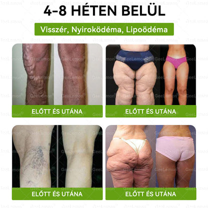 ▶Ajánlott a Semmelweis Kórház által · 👩‍⚕️BENU hivatalos üzlet| 🎁 𝐆𝐞𝑒𝐿𝑒𝐦𝐨𝐧® Glumasetide 8 az 1-ben Karcsú és Egészséges Nano Mikrotűs Tapasz