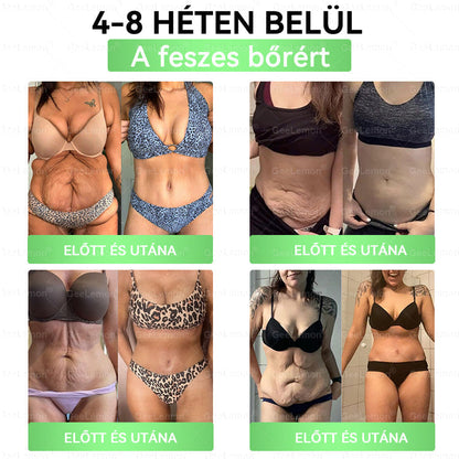 ▶Ajánlott a Semmelweis Kórház által · 👩‍⚕️BENU hivatalos üzlet| 🎁 𝐆𝐞𝑒𝐿𝑒𝐦𝐨𝐧® Glumasetide 8 az 1-ben Karcsú és Egészséges Nano Mikrotűs Tapasz